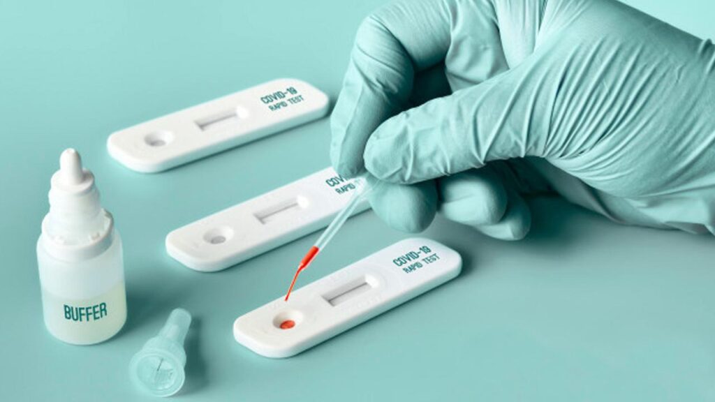 Rapid PCR Test